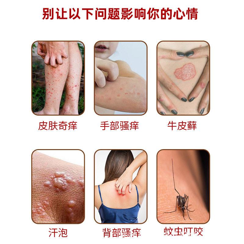 祖医仙加强型草肤毒清止痒身膏虫叮咬蚊大腿内侧JRJ百全皮肤外用