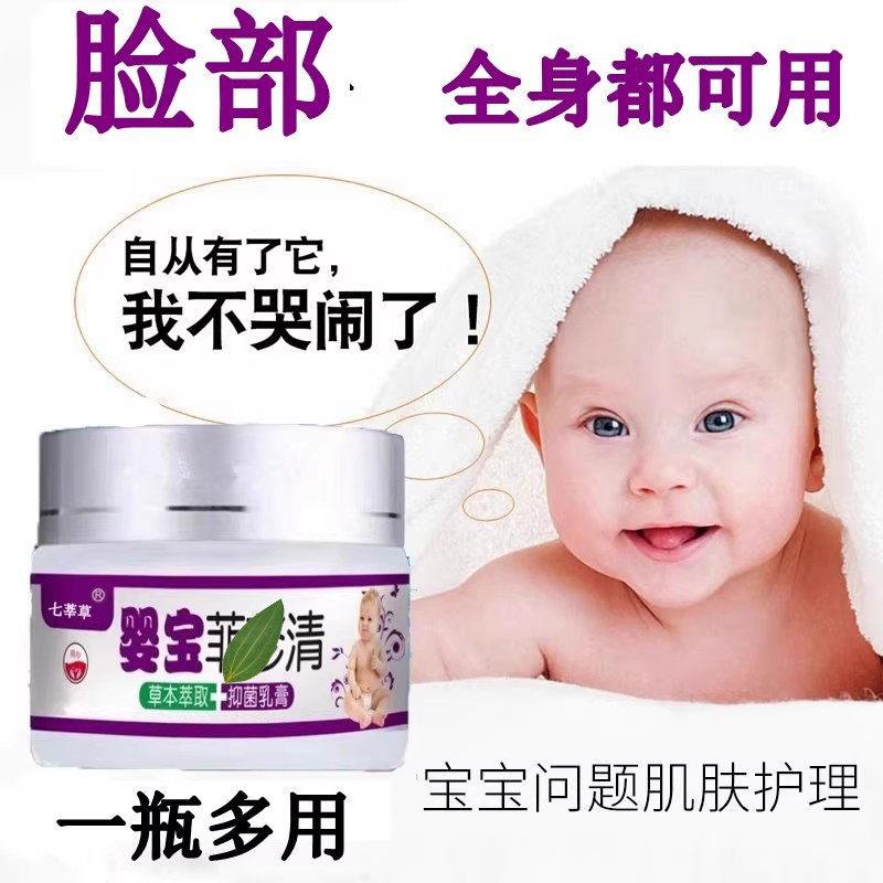 婴儿去痱子神器宝宝痱子膏水粉祛痱淹红脖子热痱护臀蚊虫叮咬膏