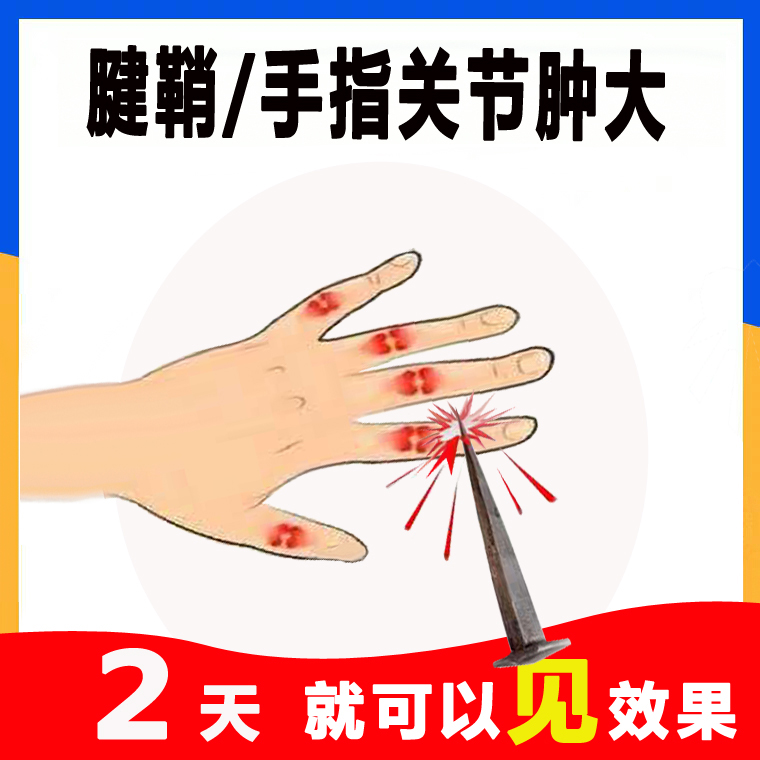 腱鞘贴健鞘炎手指关节变形肿手指关节痛手腕舒筋拇指膏貼骨痛透骨