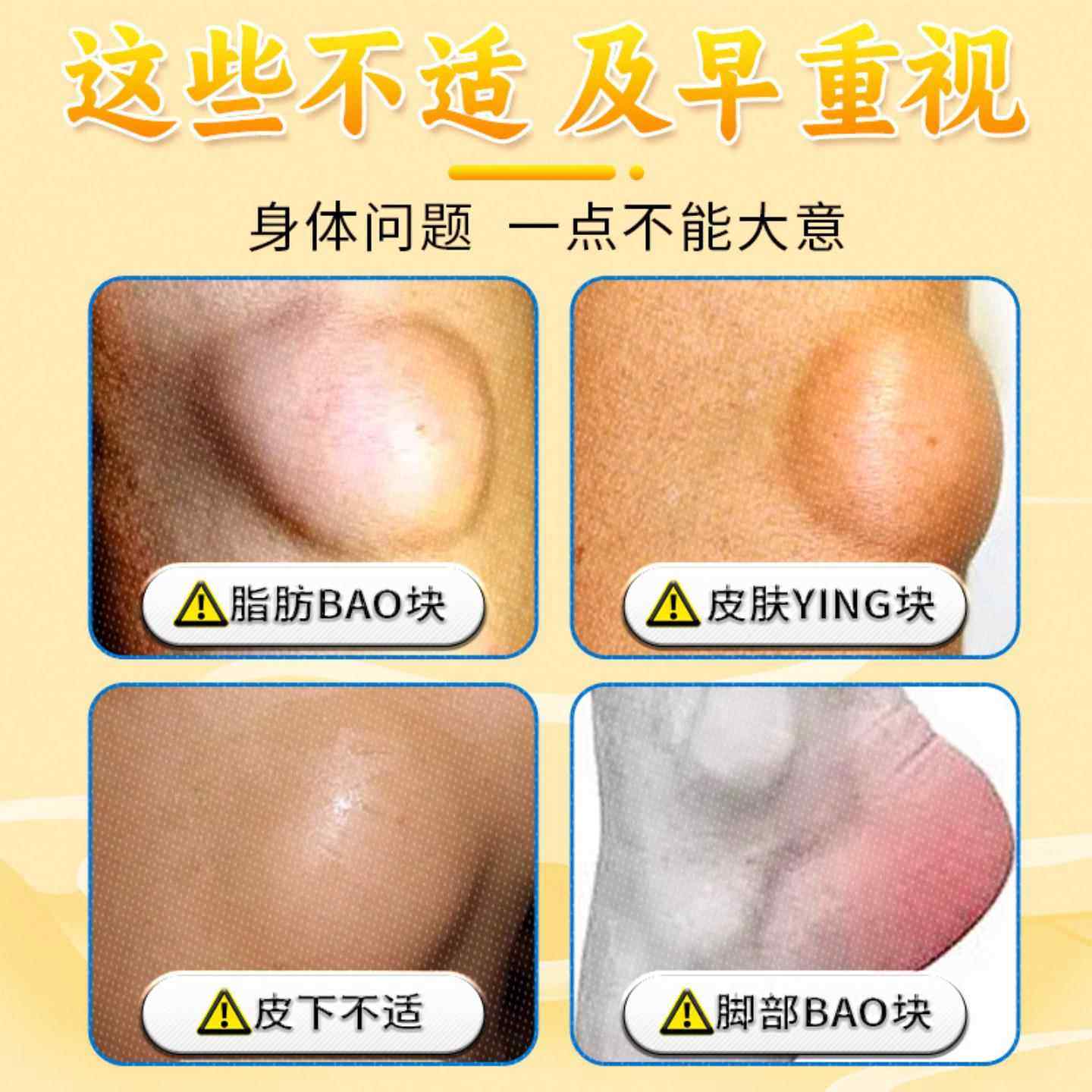 王林御0传承泰散结膏淋方巴散结膏3gBFS天猫正品,保健用品,皮肤消毒护理（消）,淘宝优惠券,粉丝福利购,淘宝优惠卷