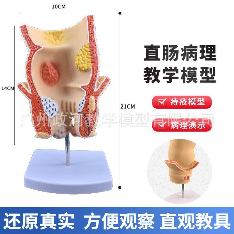 人体大654肠病理直指肠痔疮展构肠示结解剖器官结模型十二肠胃系