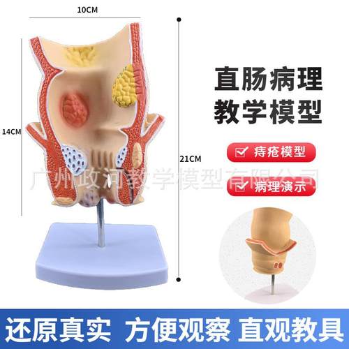 人体大654肠病理直指肠痔疮展构肠示结解剖器官结模型十二肠胃系