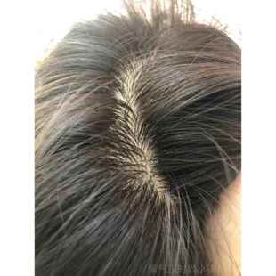 高档全形针假发男士生物头皮隐无痕双气真发头顶递补发片透三七分