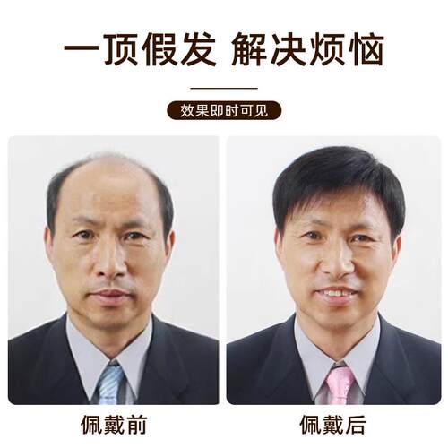 高档假发男中老真年男士假发发套气逼真爸爸短发人丝全帅头秃顶假