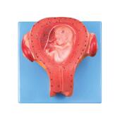 三个月胚胎模型A42005