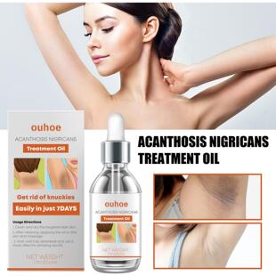 Oil moisturizes the OUHOE body Essence whole includin Body