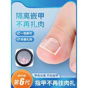 甲癣矫正神器甲真菌病特殊趾盖填充垫甲扣贴片工具矫正隔离