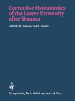 【预订】Corrective Osteotomies of the Lower ...