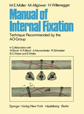 【预订】Manual of Internal Fixation: Techniq...