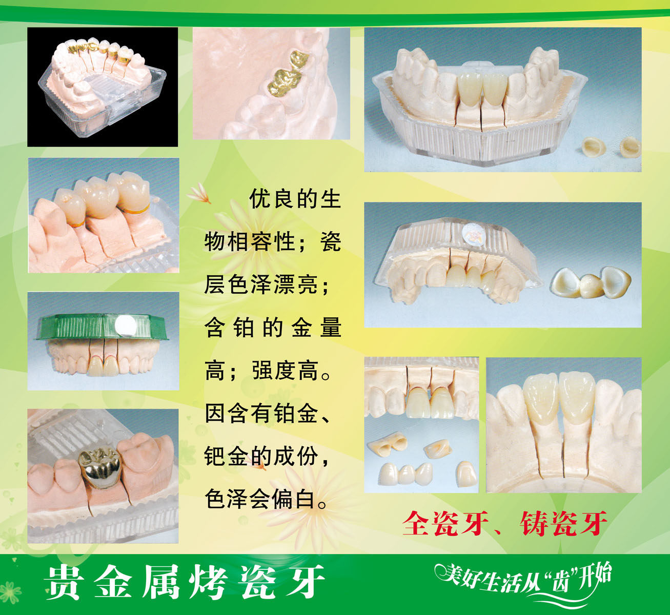 海报印制505设计展板素材8贵金属烤瓷牙定制