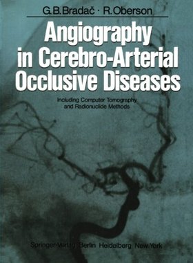 【预订】Angiography in Cerebro-Arterial Occl...