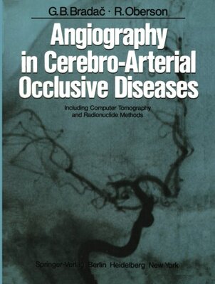 【预订】Angiography in Cerebro-Arterial Occl...