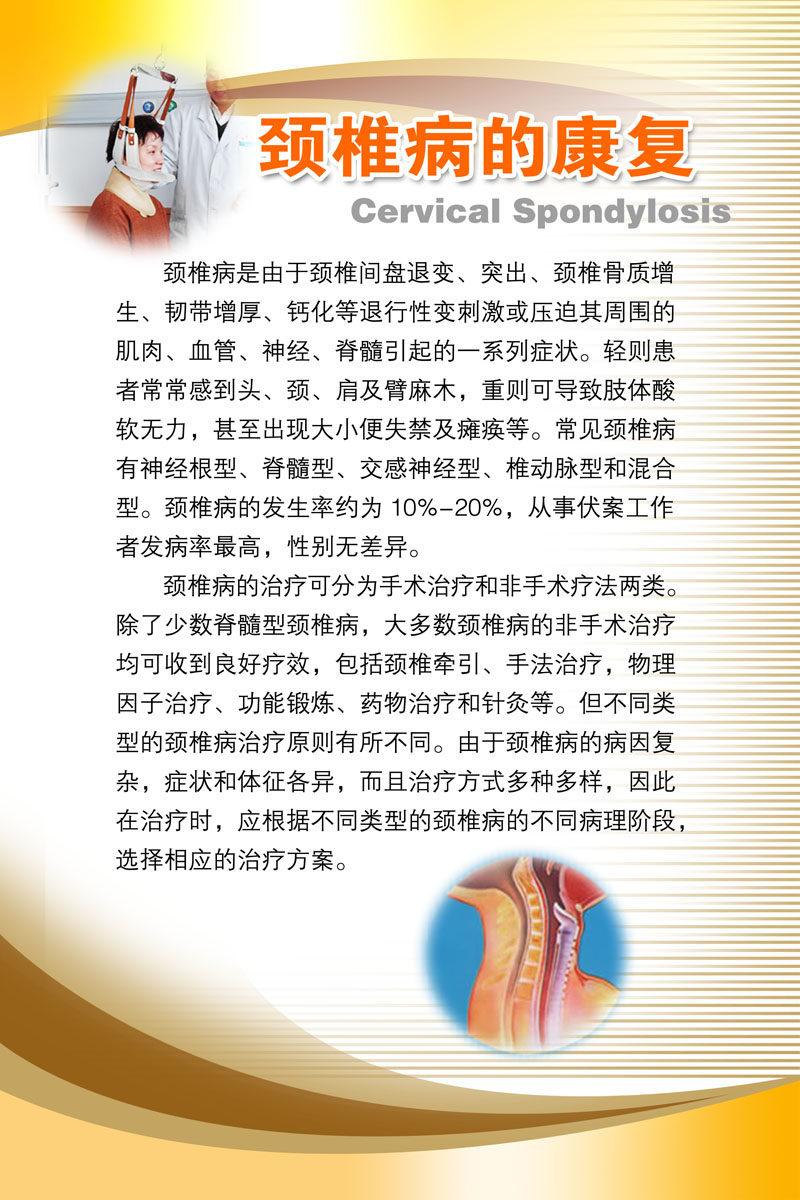 海报印制665展板素材945颈椎病的康复知识