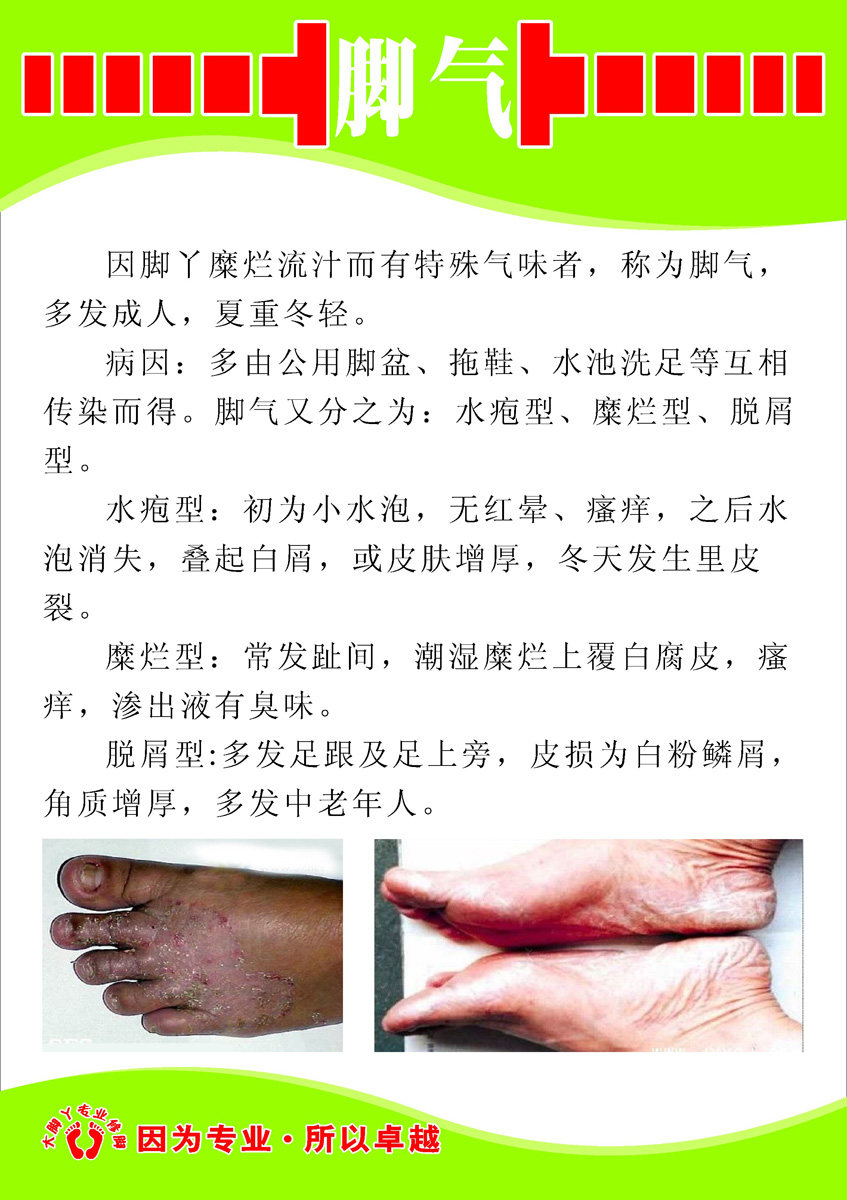 55素材医院门诊部所卫生站海报展板538脚气海报印制