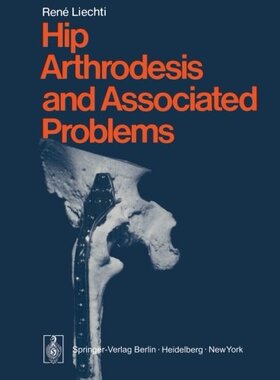 【预订】Hip Arthrodesis and Associated Problems