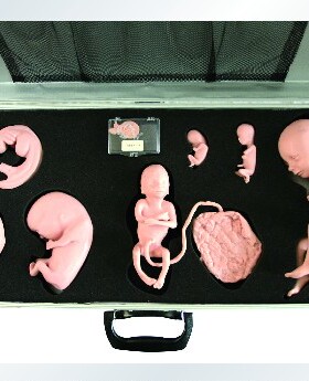 高级胚胎发育过程模型GD/FT336胎儿十月发育过程模拟人/教学培训