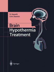 【预订】Brain Hypothermia Treatment