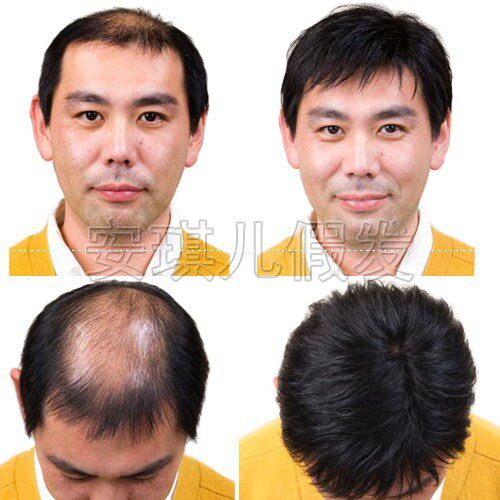 Extension cheveux - Ref 220190 Image 1