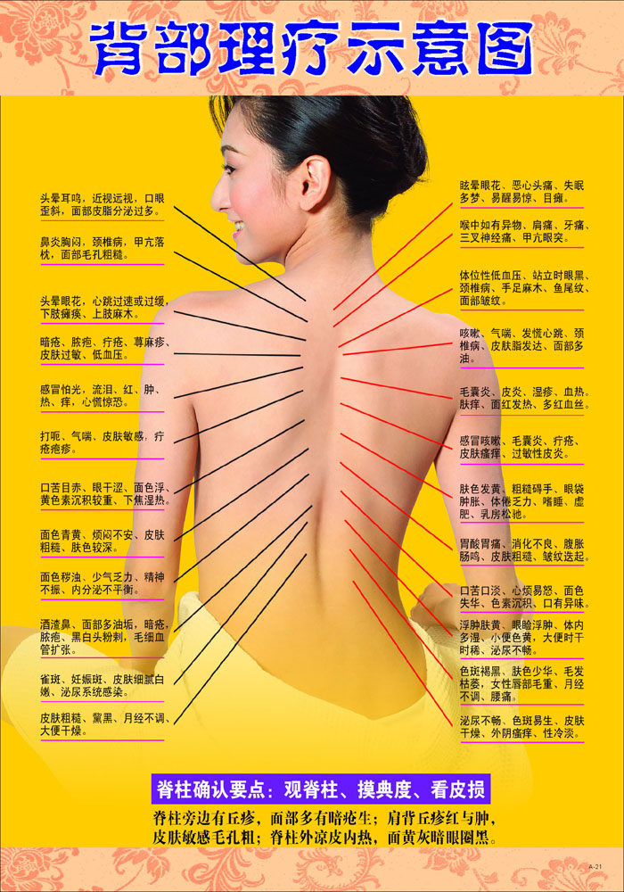 569海报印制海报展板素材179背部理疗示意图