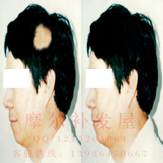 Extension cheveux - Ref 224208 Image 1