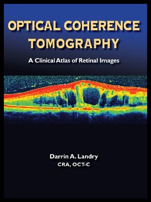 【预售】Optical Coherence Tomography