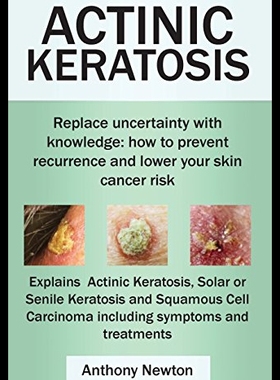 【预售】Actinic Keratosis. Replace the Fear and Uncertain