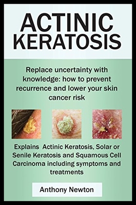 【预售】Actinic Keratosis. Replace the Fear and Uncertain