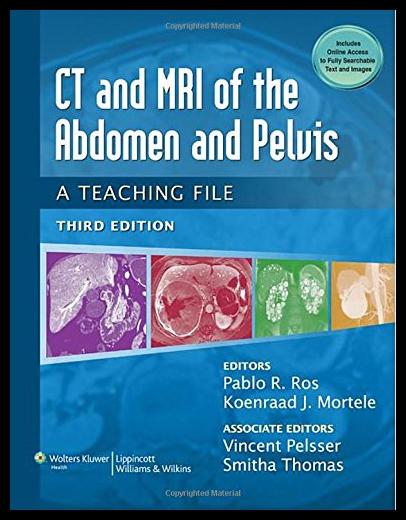 【预售】CT & MRI of the Abdomen and Pelvis: A Teaching Fi