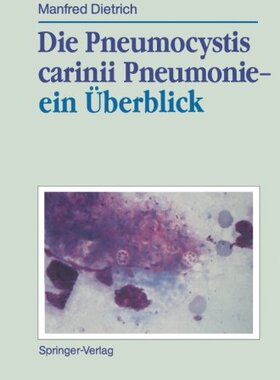 【预订】Die Pneumocystis Carinii Pneumonie E...