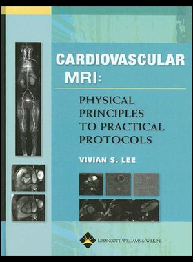 【预售】Cardiovascular MRI: Physical Principles to Practi
