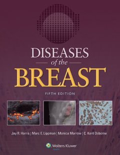 预售 Breast Diseases the