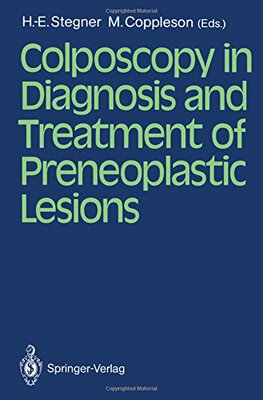 【预订】Colposcopy in Diagnosis and Treatmen...