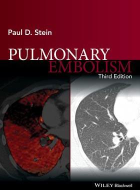 【预订】Pulmonary Embolism 3E