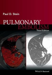 【预订】Pulmonary Embolism 3E