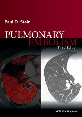 【预订】Pulmonary Embolism 3E