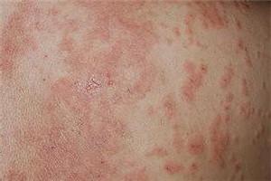 野生草药浴洗澡包安通经络艾草艾叶泡澡药包散湿起红疙瘩热气