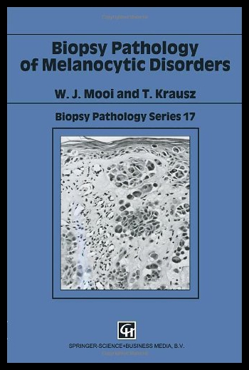 美国库房发货，通常付款后5-8周到货！