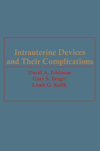 【预订】Intrauterine Devices and Their Compl...