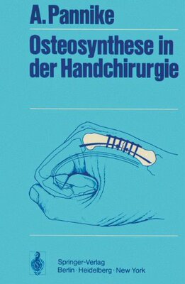 【预订】Osteosynthese in Der Handchirurgie