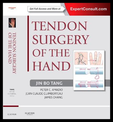 【预售】【预售】Tendon Surgery of the Ha...