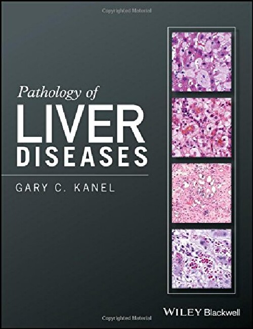 【预订】Pathology of Liver Diseases
