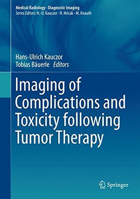【预订】Imaging of Complications and Toxicit...