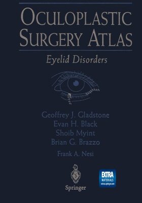 【预订】Oculoplastic Surgery Atlas: Eyelid D...