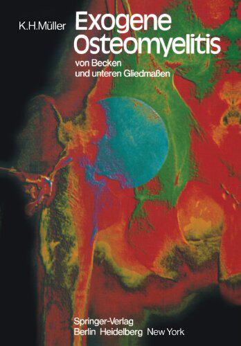 【预订】Exogene Osteomyelitis Von Becken Und...