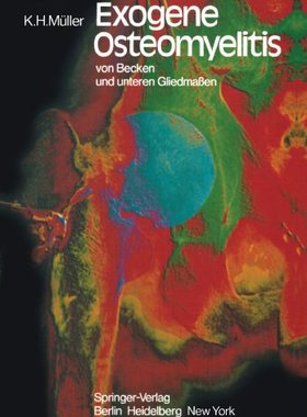 【预订】Exogene Osteomyelitis Von Becken Und...