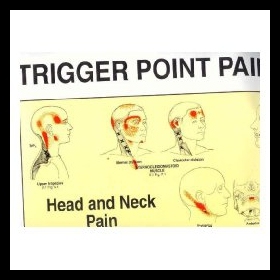 【预售】Trigger Point Pain Patterns Wall Charts