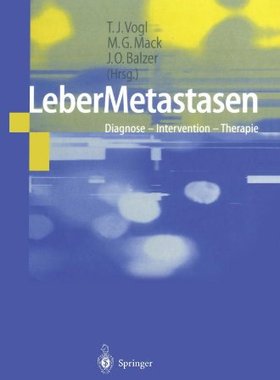 【预订】Lebermetastasen: Diagnose Interventi...
