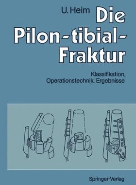 【预订】Die Pilon-Tibial-Fraktur: Klassifika...