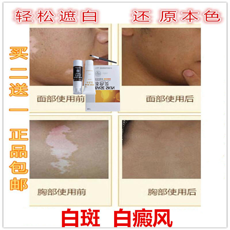 遮盖纹身胎记疤痕假皮肤隐形贴遮瑕膏白斑液强力防水持久摩擦肤蜡在类目 彩妆/香水/美妆工具, 遮瑕中 - 来自Buy2taobao.com提供专业的淘宝代购服务