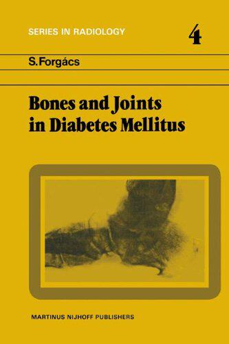 【预订】Bones and Joints in Diabetes Mellitus